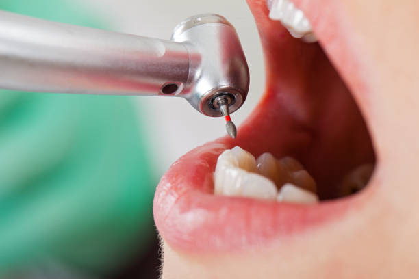 Best Emergency Wisdom Teeth Removal in Flippin, AR